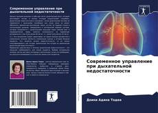 Portada del libro de Современное управление при дыхательной недостаточности