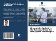 Couverture de Chirurgische Technik für die Ostheosynthese des verriegelten Fersennagels