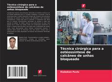 Обложка Técnica cirúrgica para a ostéossíntese de calcâneo de unhas bloqueado