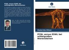 Capa do livro de PCNL versus ESWL bei mittelgroßen Nierensteinen 