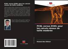 PCNL versus ESWL pour les calculs rénaux de taille modérée kitap kapağı