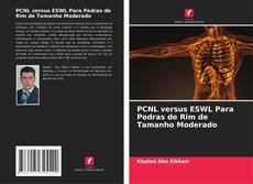 Buchcover von PCNL versus ESWL Para Pedras de Rim de Tamanho Moderado
