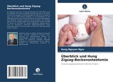 Buchcover von Überblick und Hung Zigzag-Beckenosteotomie