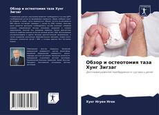 Buchcover von Обзор и остеотомия таза Хунг Зигзаг