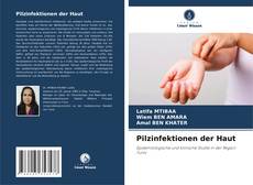 Buchcover von Pilzinfektionen der Haut