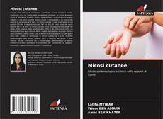 Bookcover of Micosi cutanee