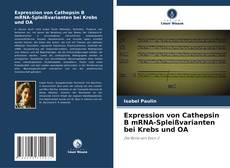 Capa do livro de Expression von Cathepsin B mRNA-Spleißvarianten bei Krebs und OA 