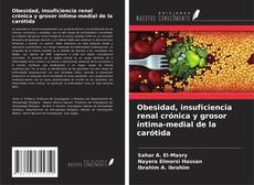 Borítókép a  Obesidad, insuficiencia renal crónica y grosor íntima-medial de la carótida - hoz