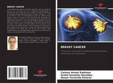 Buchcover von BREAST CANCER