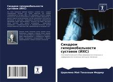 Buchcover von Синдром гипермобильности суставов (ЙХС)