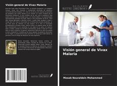 Bookcover of Visión general de Vivax Malaria