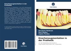 Copertina di Knochenaugmentation in der Prothetik