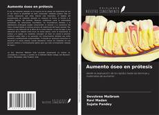 Buchcover von Aumento óseo en prótesis