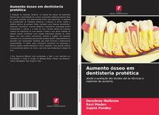 Buchcover von Aumento ósseo em dentisteria protética