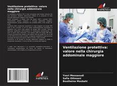 Buchcover von Ventilazione protettiva: valore nella chirurgia addominale maggiore