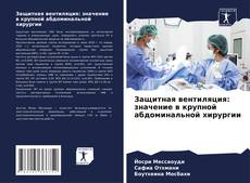 Copertina di Защитная вентиляция: значение в крупной абдоминальной хирургии