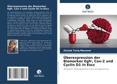 Copertina di Überexpression der Biomarker Egfr, Cox-2 und Cyclin D1 in Escc