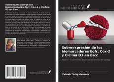 Buchcover von Sobreexpresión de los biomarcadores Egfr, Cox-2 y Ciclina D1 en Escc