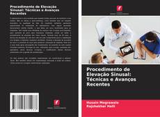 Bookcover of Procedimento de Elevação Sinusal: Técnicas e Avanços Recentes