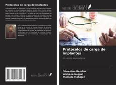 Protocolos de carga de implantes kitap kapağı