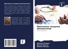 Bookcover of Протоколы загрузки имплантатов