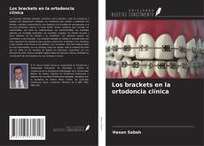 Couverture de Los brackets en la ortodoncia clínica