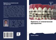 Buchcover von Брекеты в клинической ортодонтии