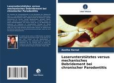 Portada del libro de Laserunterstütztes versus mechanisches Debridement bei chronischer Parodontitis