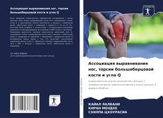 Bookcover of Ассоциация выравнивания ног, торсии большеберцовой кости и угла Q