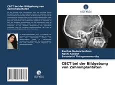 CBCT bei der Bildgebung von Zahnimplantaten kitap kapağı