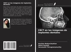 Bookcover of CBCT en las imágenes de implantes dentales