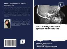 CBCT в визуализации зубных имплантатов kitap kapağı