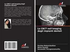 Bookcover of La CBCT nell'imaging degli impianti dentali
