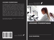 Bookcover of LESIONES PIGMENTADAS