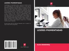 Buchcover von LESÕES PIGMENTADAS