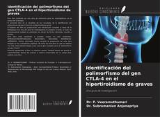 Buchcover von Identificación del polimorfismo del gen CTLA-4 en el hipertiroidismo de graves