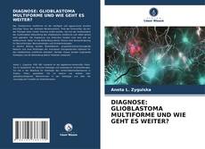Bookcover of DIAGNOSE: GLIOBLASTOMA MULTIFORME UND WIE GEHT ES WEITER?
