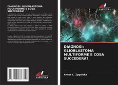 Bookcover of DIAGNOSI: GLIOBLASTOMA MULTIFORME E COSA SUCCEDERÀ?