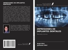 Bookcover of IMPRESIONES DE IMPLANTES DENTALES