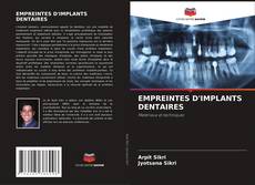 Bookcover of EMPREINTES D'IMPLANTS DENTAIRES