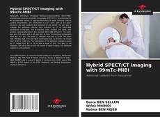 Copertina di Hybrid SPECT/CT imaging with 99mTc-MIBI