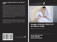 Bookcover of Imagen híbrida SPECT/CT de 99mTc-MIBI