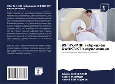 Bookcover of 99mTc-MIBI гибридная ОФЭКТ/КТ визуализация
