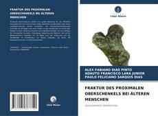 Capa do livro de FRAKTUR DES PROXIMALEN OBERSCHENKELS BEI ÄLTEREN MENSCHEN 
