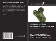 Bookcover of FRACTURA DE FÉMUR PROXIMAL DE EDAD AVANZADA
