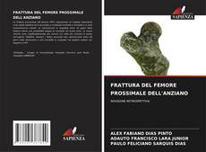 Bookcover of FRATTURA DEL FEMORE PROSSIMALE DELL'ANZIANO