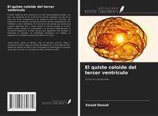 Обложка El quiste coloide del tercer ventrículo