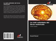 Buchcover von La cisti colloidale del terzo ventricolo
