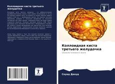 Bookcover of Коллоидная киста третьего желудочка