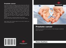 Couverture de Prostate cancer